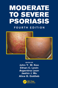 Cover image: Moderate to Severe Psoriasis 4th edition 9781138626140