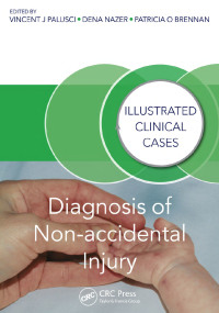 Cover image: Diagnosis of Non-accidental Injury 1st edition 9781482230130