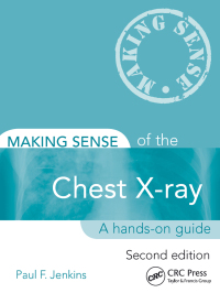Imagen de portada: Making Sense of the Chest X-ray 2nd edition 9781444135152
