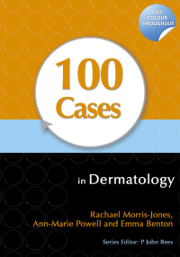 صورة الغلاف: 100 Cases in Dermatology 1st edition 9781444117936
