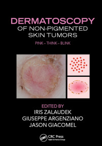 Cover image: Dermatoscopy of Non-Pigmented Skin Tumors 1st edition 9781482237528