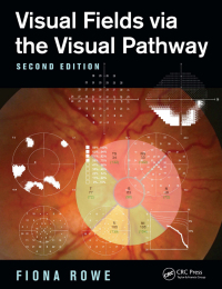 Cover image: Visual Fields via the Visual Pathway 2nd edition 9781482299632