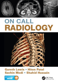 Cover image: On Call Radiology 1st edition 9781482221671