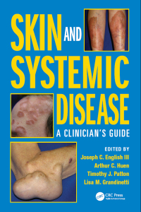صورة الغلاف: Skin and Systemic Disease 1st edition 9781482221589