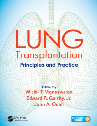 صورة الغلاف: Lung Transplantation 1st edition 9781482233919
