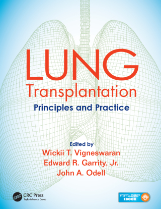 صورة الغلاف: Lung Transplantation 1st edition 9781482233919
