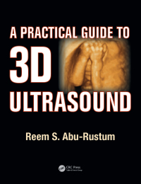 Cover image: A Practical Guide to 3D Ultrasound 1st edition 9781138455078