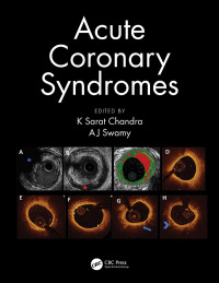 Cover image: Acute Coronary Syndromes 1st edition 9780367112226