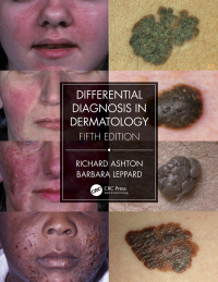 Cover image: Differential Diagnosis in Dermatology 5th edition 9781032164250