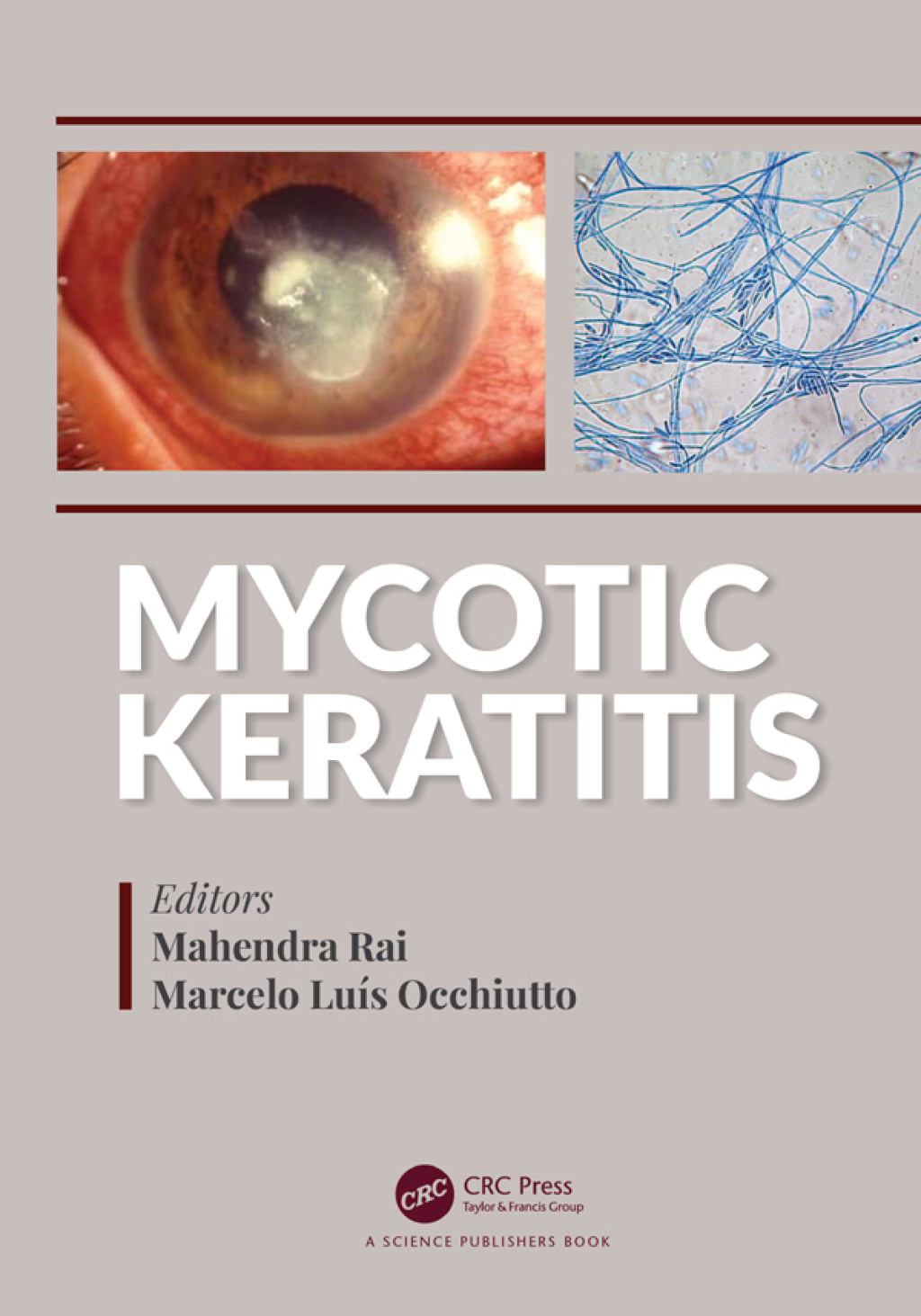 Mycotic Keratitis 1st Edition
