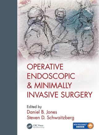 Cover image: Operative Endoscopic and Minimally Invasive Surgery 1st edition 9781498708302