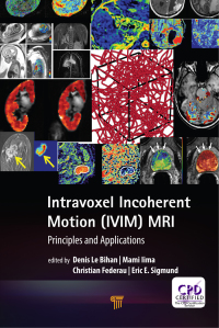 Cover image: Intravoxel Incoherent Motion (IVIM) MRI 1st edition 9789814800198