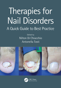 Imagen de portada: Therapies for Nail Disorders 1st edition 9781138370364