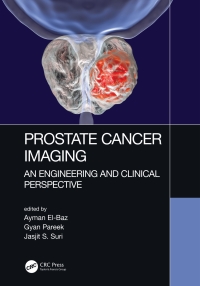 Omslagafbeelding: Prostate Cancer Imaging 1st edition 9781498786232