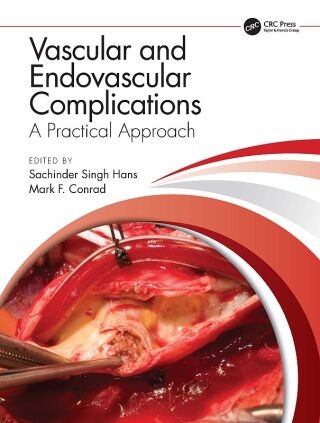 Cover image: Vascular and Endovascular Complications: A Practical Approach 1st edition 9781138352933