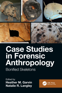 Cover image: Case Studies in Forensic Anthropology 1st edition 9781138347656