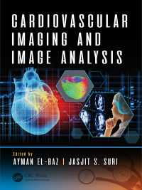 Imagen de portada: Cardiovascular Imaging and Image Analysis 1st edition 9781498797580