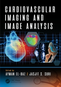 Cover image: Cardiovascular Imaging and Image Analysis 1st edition 9781498797580