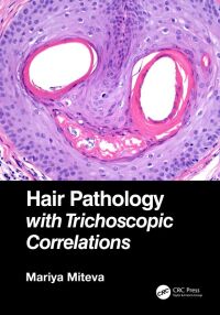 Cover image: Hair Pathology with Trichoscopic Correlations 1st edition 9781138313538