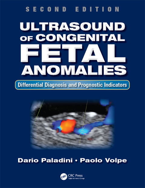 Ultrasound of Congenital Fetal Anomalies: Differential Diagnosis and Prognostic Indicators, Second Edition, 2nd  Edition - FULL INSTANT DOWNLOAD | PDF DOCX EPUB