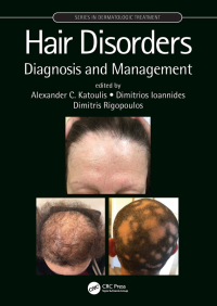 表紙画像: Hair Disorders 1st edition 9781138611900