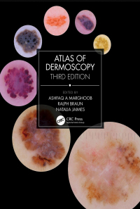 Cover image: Atlas of Dermoscopy 3rd edition 9781138595989