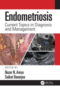 Cover image: Endometriosis 1st edition 9781138595873