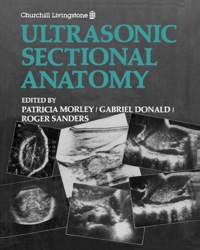 Immagine di copertina: Ultrasonic Sectional Anatomy 9780443016905