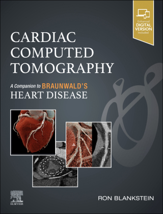 Imagen de portada: Cardiac Computed Tomography 1st edition 9780443106187