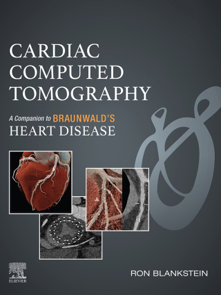 Imagen de portada: Cardiac Computed Tomography 9780443106187