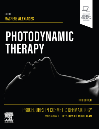 Cover image: Procedures in Cosmetic Dermatology Series: Photodynamic Therapy 3rd edition 9780443106897