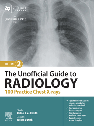 Cover image: The Unofficial Guide to Radiology: 100 Practice Chest X Rays 2nd edition 9780443109171