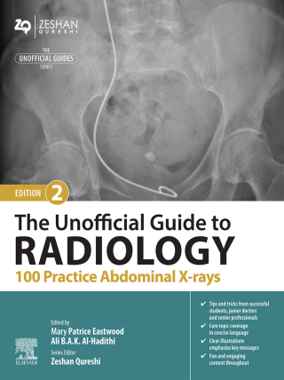 Immagine di copertina: The Unofficial Guide to Radiology: 100 Practice Abdominal X Rays 2nd edition 9780443109188