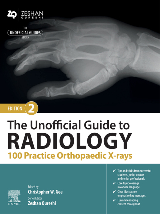 Cover image: The Unofficial Guide to Radiology: 100 Practice Orthopaedic X Rays 2nd edition 9780443109195