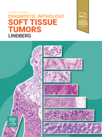 Imagen de portada: Diagnostic Pathology: Soft Tissue Tumors 4th edition 9780443109362
