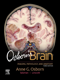 Cover image: Osborn's Brain 3rd edition 9780443109379