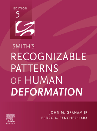 Cover image: Smith's Recognizable Patterns of Human Deformation 5th edition 9780443114144
