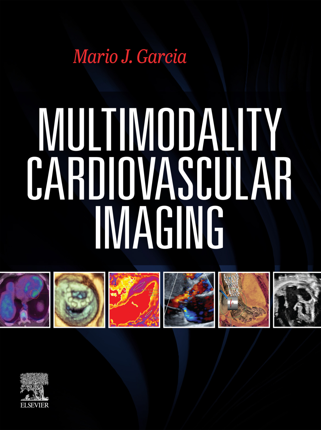 Multimodal Cardiac Imaging 1st Edition