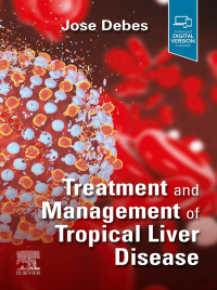 Immagine di copertina: Treatment and Management of Tropical Liver Disease 9780323870313