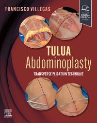 Cover image: TULUA Abdominoplasty 9780443118821