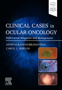 Cover image: Clinical Cases in Ocular Oncology 1st edition 9780443120497