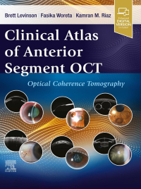 Cover image: Clinical Atlas of Anterior Segment OCT: Ocular Coherence Tomography 1st edition 9780443120466