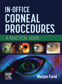 Imagen de portada: In-Office Corneal Procedures 9780443125898