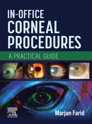 Cover image: In-Office Corneal Procedures 9780443125898