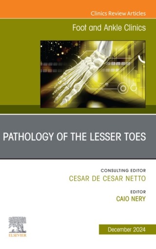 Cover image: Pathology of the Lesser Toes, An issue of Foot and Ankle Clinics of North America 9780443129117