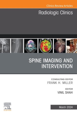 Omslagafbeelding: Spine Imaging and Intervention, An Issue of Radiologic Clinics of North America 1st edition 9780443130175