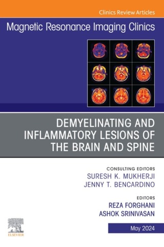Cover image: Demyelinating and Inflammatory Lesions of the Brain and Spine, An Issue of Magnetic Resonance Imaging Clinics of North America 1st edition 9780443131691