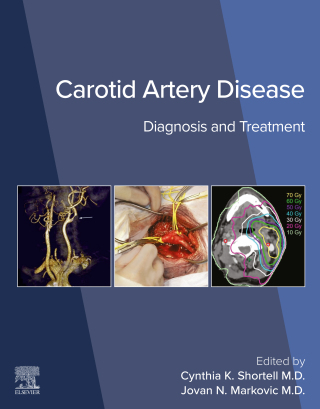 Cover image: Carotid Artery Disease 9780443138652
