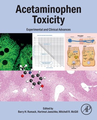 Cover image: Acetaminophen Toxicity 9780443158773