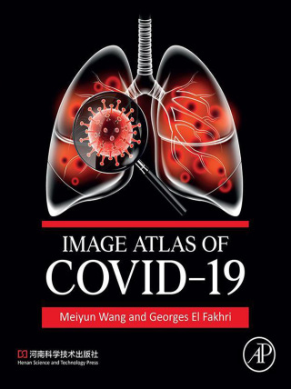 Cover image: Image Atlas of COVID-19 1st edition 9780443184932